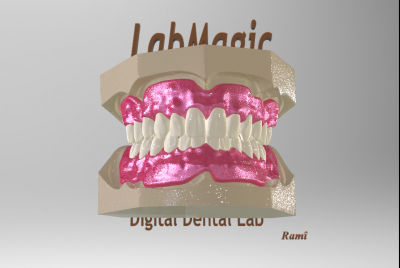 Dentiere digitali complete